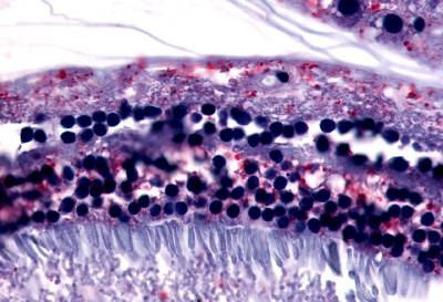 GPR75 Antibody in Immunohistochemistry (Paraffin) (IHC (P))