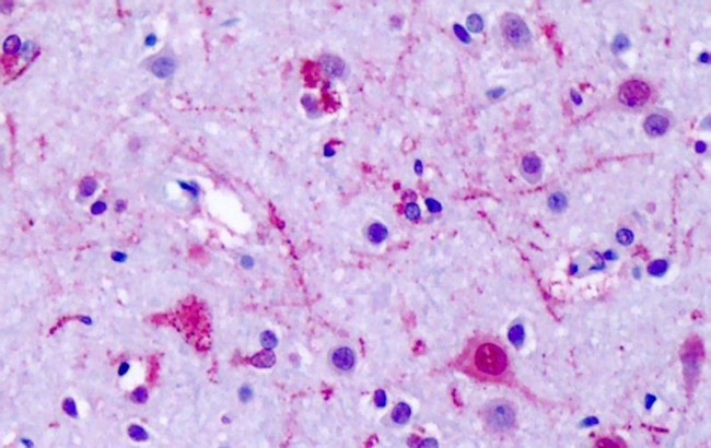 GPR75 Antibody in Immunohistochemistry (Paraffin) (IHC (P))