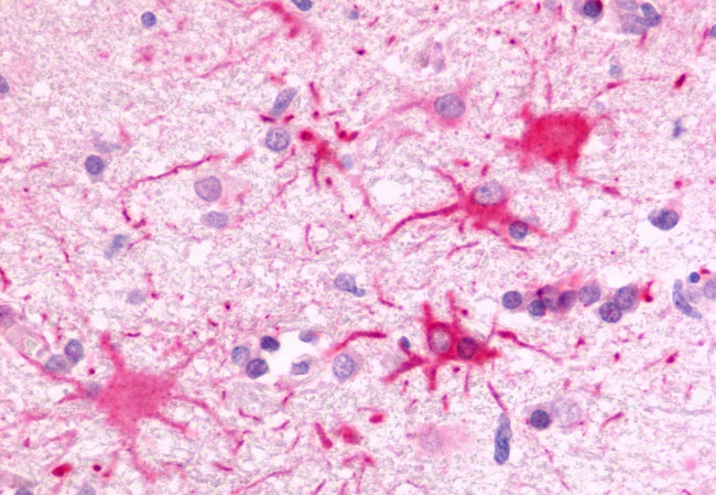 GPR81 Antibody in Immunohistochemistry (Paraffin) (IHC (P))