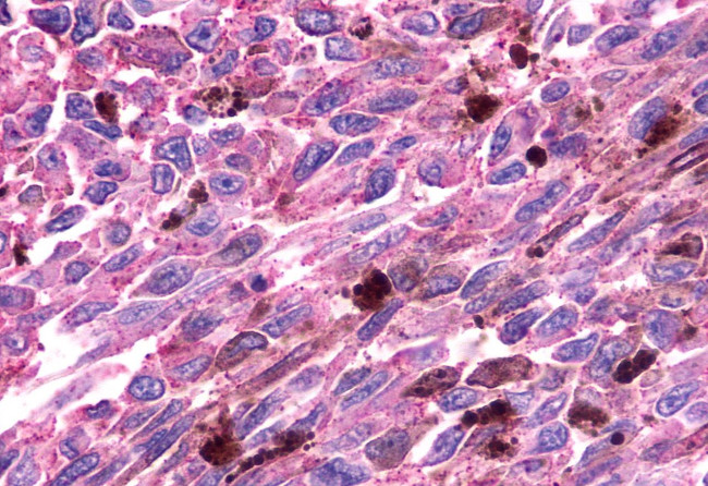 GPR81 Antibody in Immunohistochemistry (Paraffin) (IHC (P))