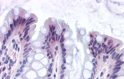 GPR82 Antibody in Immunohistochemistry (Paraffin) (IHC (P))