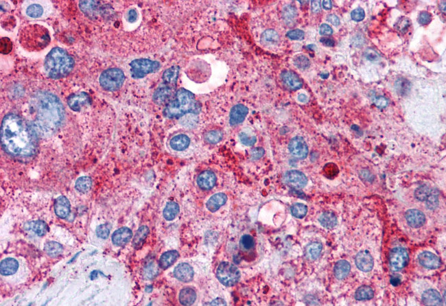 GPR82 Antibody in Immunohistochemistry (Paraffin) (IHC (P))