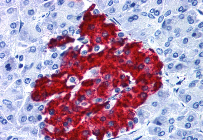 GPR82 Antibody in Immunohistochemistry (Paraffin) (IHC (P))