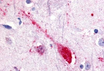 GPR85 Antibody in Immunohistochemistry (Paraffin) (IHC (P))