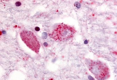 GPR85 Antibody in Immunohistochemistry (Paraffin) (IHC (P))