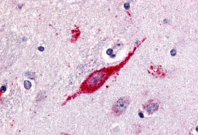 GPR85 Antibody in Immunohistochemistry (Paraffin) (IHC (P))