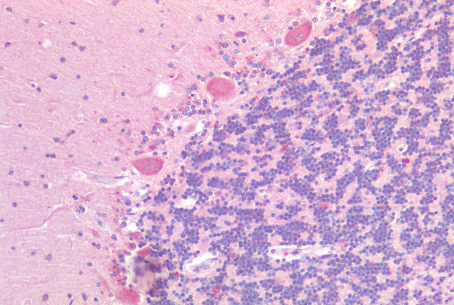 GPR87 Antibody in Immunohistochemistry (Paraffin) (IHC (P))