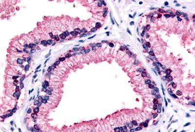 GPR87 Antibody in Immunohistochemistry (Paraffin) (IHC (P))