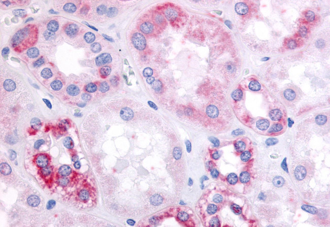 GPR91 Antibody in Immunohistochemistry (Paraffin) (IHC (P))