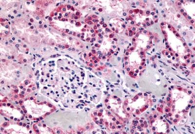 GPR91 Antibody in Immunohistochemistry (Paraffin) (IHC (P))