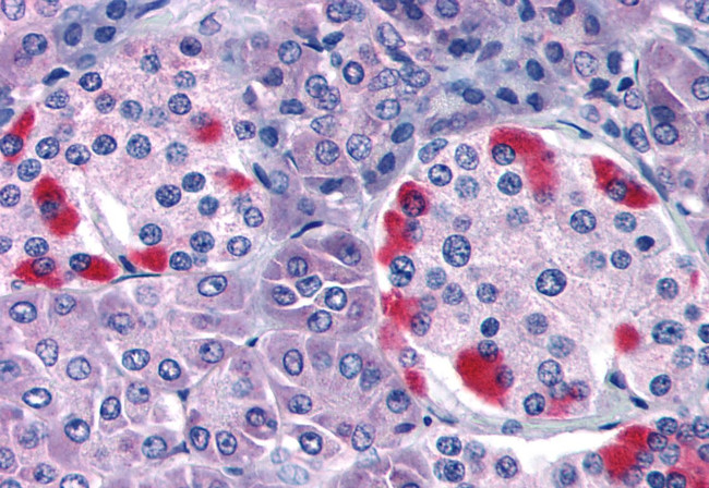 GPRC5C Antibody in Immunohistochemistry (Paraffin) (IHC (P))