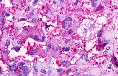 GPRC5D Antibody in Immunohistochemistry (Paraffin) (IHC (P))