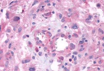 GPRC6A Antibody in Immunohistochemistry (Paraffin) (IHC (P))