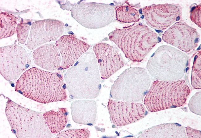 GPRC6A Antibody in Immunohistochemistry (Paraffin) (IHC (P))