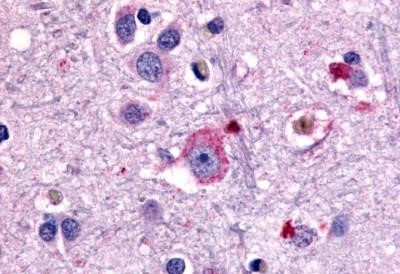 mGluR1 Antibody in Immunohistochemistry (Paraffin) (IHC (P))