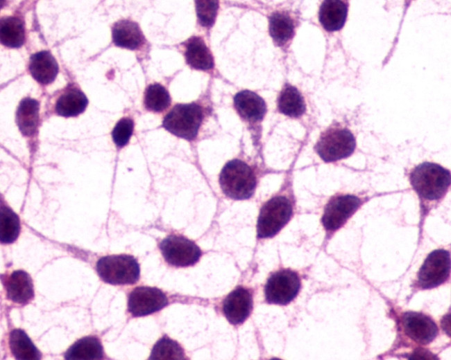 mGluR3 Antibody in Immunocytochemistry (ICC/IF)