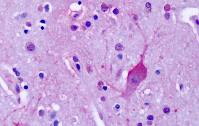mGluR4 Antibody in Immunohistochemistry (Paraffin) (IHC (P))