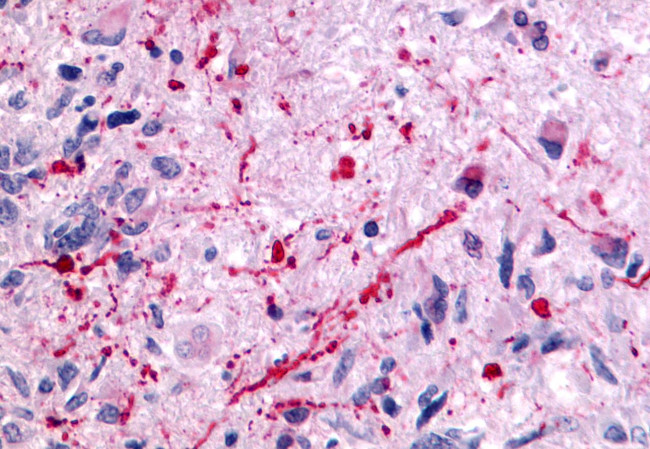 mGluR5 Antibody in Immunohistochemistry (Paraffin) (IHC (P))