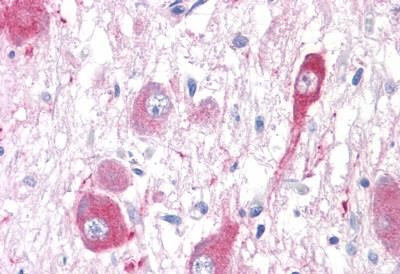 mGluR5 Antibody in Immunohistochemistry (Paraffin) (IHC (P))
