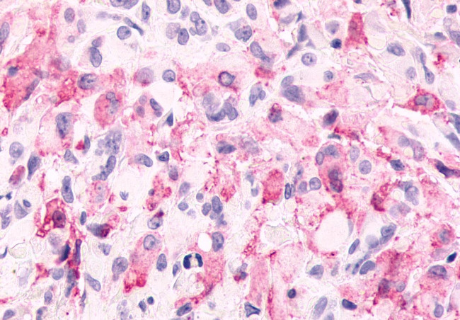 mGluR6 Antibody in Immunohistochemistry (Paraffin) (IHC (P))