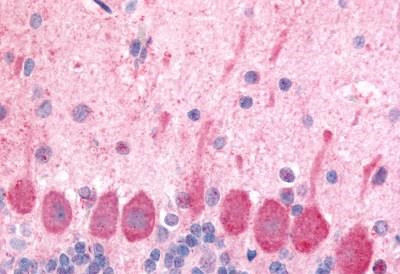 Orexin Receptor 1 Antibody in Immunohistochemistry (Paraffin) (IHC (P))