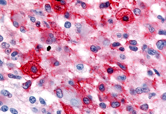 HNF4G Antibody in Immunohistochemistry (Paraffin) (IHC (P))