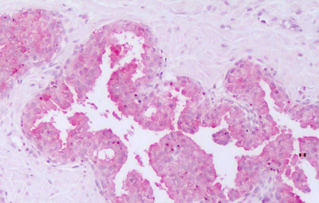 HUNK Antibody in Immunohistochemistry (Paraffin) (IHC (P))