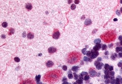 OPRK1 Antibody in Immunohistochemistry (Paraffin) (IHC (P))