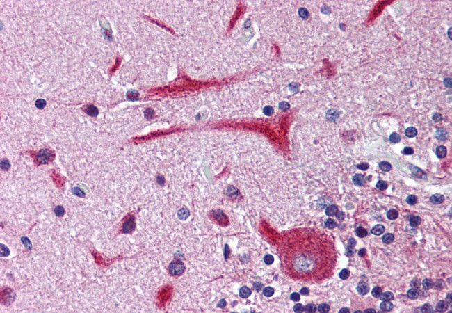KCNH2 Antibody in Immunohistochemistry (Paraffin) (IHC (P))
