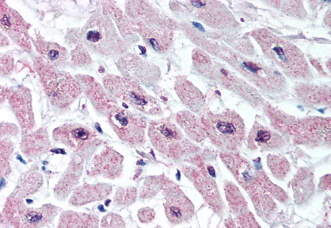 Kir3.1 (KCNJ3) Antibody in Immunohistochemistry (Paraffin) (IHC (P))
