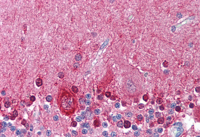 KCNMA1 Antibody in Immunohistochemistry (Paraffin) (IHC (P))