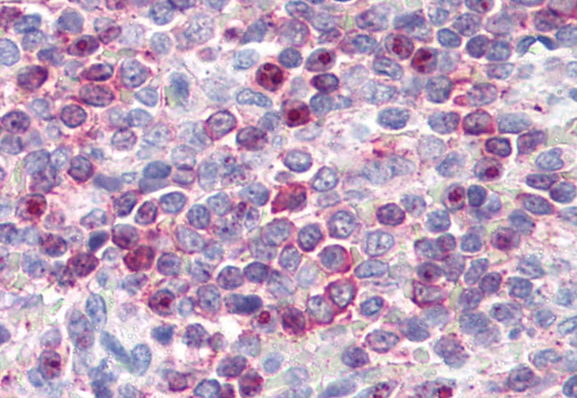 LTB4R Antibody in Immunohistochemistry (Paraffin) (IHC (P))