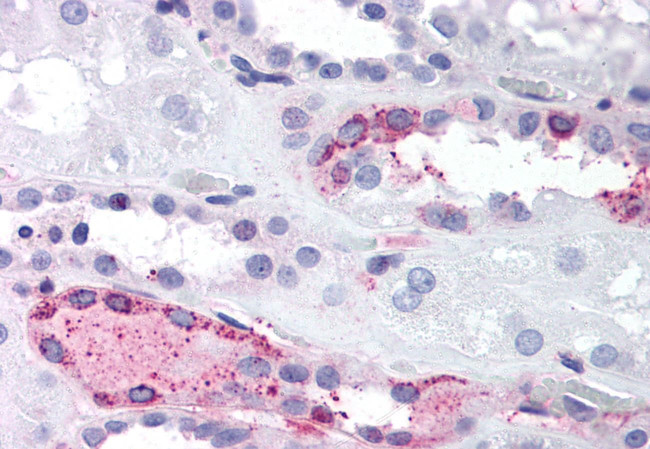 LPAR4 Antibody in Immunohistochemistry (Paraffin) (IHC (P))