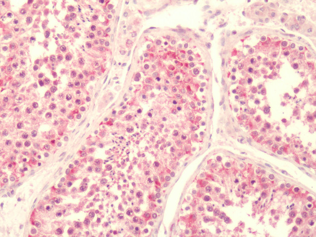 LPAR5 Antibody in Immunohistochemistry (Paraffin) (IHC (P))