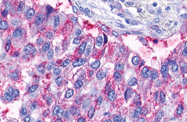 LPAR6 Antibody in Immunohistochemistry (Paraffin) (IHC (P))
