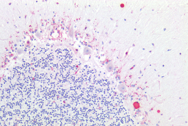 LPHN1 Antibody in Immunohistochemistry (Paraffin) (IHC (P))
