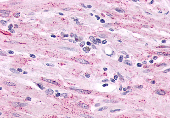 LPHN2 Antibody in Immunohistochemistry (Paraffin) (IHC (P))