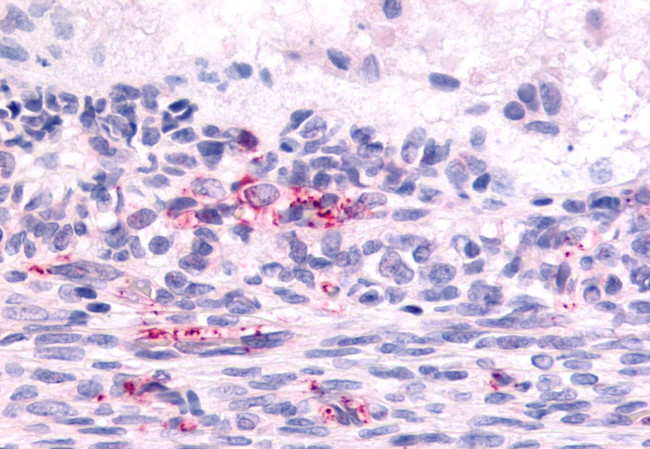 LPHN2 Antibody in Immunohistochemistry (Paraffin) (IHC (P))