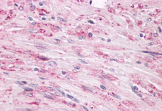 LPHN2 Antibody in Immunohistochemistry (Paraffin) (IHC (P))