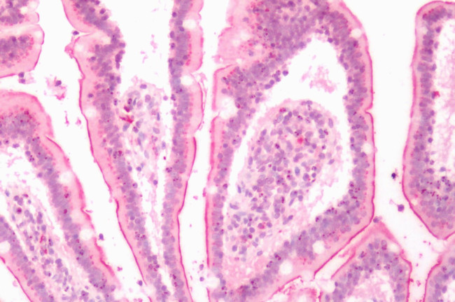 LTB4R2 Antibody in Immunohistochemistry (Paraffin) (IHC (P))