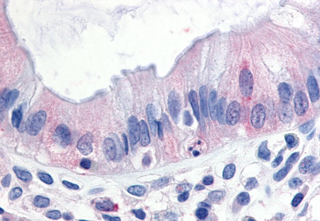 TPL2 Antibody in Immunohistochemistry (Paraffin) (IHC (P))