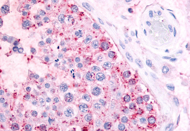 MAS1 Antibody in Immunohistochemistry (Paraffin) (IHC (P))