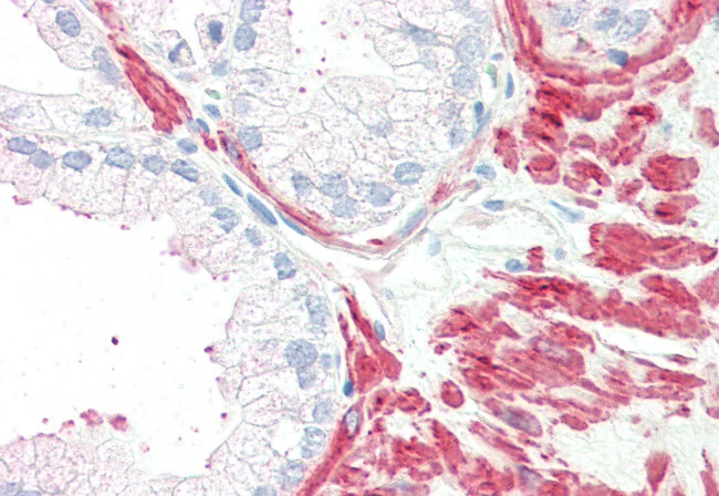 MC5R Antibody in Immunohistochemistry (Paraffin) (IHC (P))