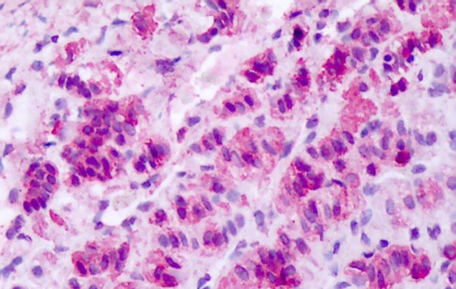 MCHR1 Antibody in Immunohistochemistry (Paraffin) (IHC (P))