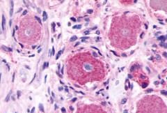 MRGPRE Antibody in Immunohistochemistry (Paraffin) (IHC (P))