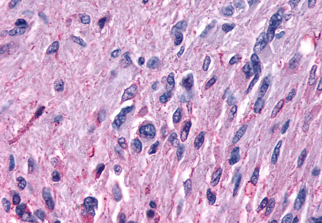 MRGPRF Antibody in Immunohistochemistry (Paraffin) (IHC (P))