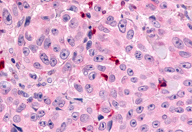 MRGPRX1 Antibody in Immunohistochemistry (Paraffin) (IHC (P))