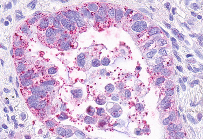 MRGPRX3 Antibody in Immunohistochemistry (Paraffin) (IHC (P))