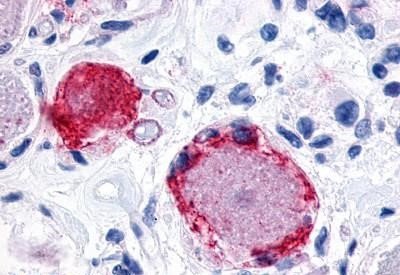 MRGPRX3 Antibody in Immunohistochemistry (Paraffin) (IHC (P))