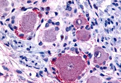 MRGPRX4 Antibody in Immunohistochemistry (Paraffin) (IHC (P))